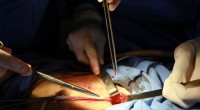Se informó que un grupo de cirujanos cardiovasculares realizaron la primera cirugía de corazón abierto en el Hospital Regional ISSSTE Morelia, a una derechohabiente de 57 años de edad quien […]