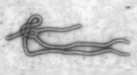 Con más de 20 brotes de ébola, y su expansión en el Continente Africano, se teme que este virus, que apareció en 1976, esté de regreso y con una capacidad […]
